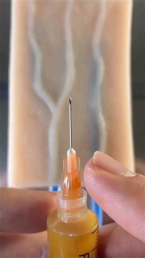 How To Insert Needle Into The Side Of The Vein #goodtoknow #vet #medicine #funfacts #lifehacks