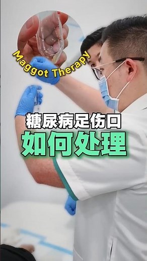 How Maggot Therapy Heals Diabetic Foot Ulcers 蛆虫疗法如何治疗糖尿病足伤口 | Prinz Klinik 品医诊所 #maggottherapy