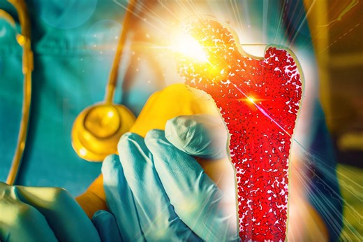 Bent Bone Dysplasia: Diagnosis, Prognosis and Management