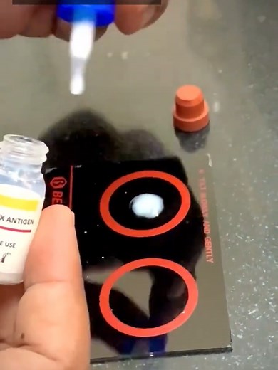 Understanding CRP Tests in Pathology