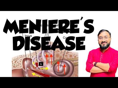 Meniere's disease | Causes | Pathophysiology | Sign & Symptoms | Medical & Surgical Management