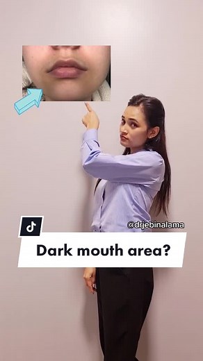 Causes of Perioral Hyperpigmentation