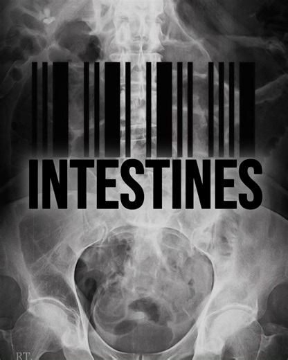 #intestines #digestion #digestivesystem #anatomy #edit | Digestive Health