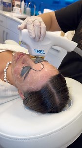 BBL (BroadBand Light) therapy is an effective treatment for uneven...