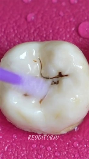 Parte 1 mi hermano robó el dinero destinado al tratamiento de mi madre y ahora que ella ha fallecido#historia #reddit #redditstories #redditespañol #estadosunidos