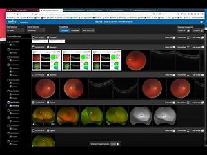 Understanding Image Management in Eyefinity EHR