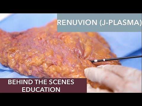 How does Renuvion (J-Plasma) work?