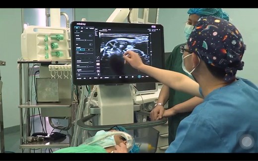 超声引导下上、下肢神经阻滞workshop演示