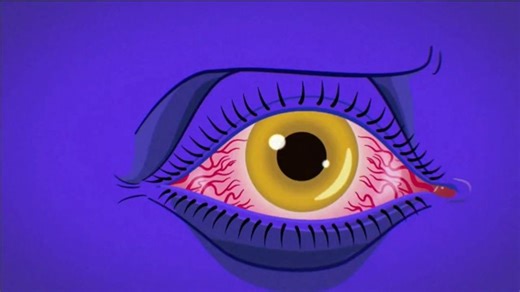 Tepezza TV Spot, 'Seeing Red'