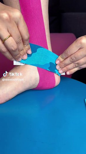 How to Kinesiology Tape the inner ankle? Kinesiology Tape helps with inside ankle tendonitis by supporting the arch, reducing strain, and improving proprioception.##KinesiologyTape ##PhysicalTherapy #Ankle #tendinitis #fyp