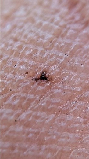 Mobile Microscopic View 😍