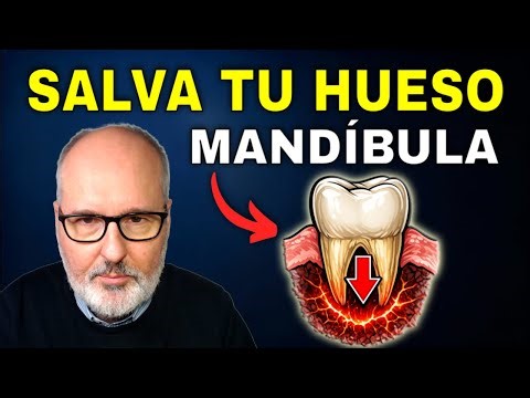 ¿Te falta hueso para implantes? Cómo salvar tu mandíbula