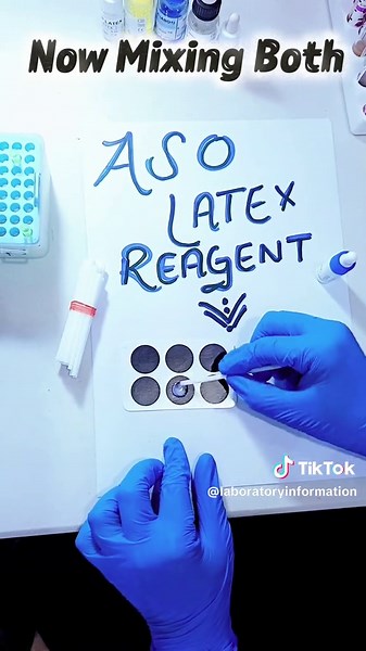 ASO Test . What is the normal range of ASO titer in adults and children?#diseases #Infection #Bacteria #foryoupage❤️❤️ #grow 🇫🇷🇫🇷👆👆👆