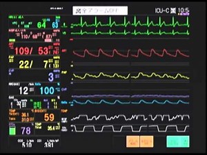 5極誘導心電図