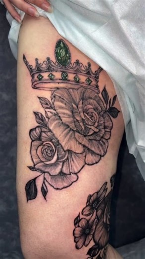 Dr.Dina Elharony on Instagram‎: ""عارف إن التاتو العلاجي ممكن يداري آثار العمليات تماماً؟ 🤔" تقنياتنا بتدمج اللون الطبيعي لبشرتك مع المنطقة المصابة عشان ترجع كأنها مكنتش موجودة. 👇 لو عندك استفسار، اسألنا هنا وهنرد عليك. #فرصة_تانية #تاتو_علاجي #تاتو_تجميلى #فرصة_تانية #تاتو_علاجي تاتو_تجميلي MedicalTattoo ParamedicalTattooعلاج_الحروق آثار_العمليات تصبغات_البشرة الكلف ندبات البهاق توحيد_لون_الجسم تغطية_الندباتتجميل جلدية_وتجميل عناية_بالبشرة ثقة_بالنفس جمالك SkinCare CamouflageTattooMcamouflage