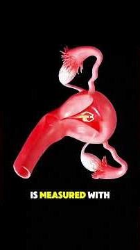 Long-Term Birth Control Explained Simply #3dmedicalanimation #aigenerated #iud #womenhealth #3d