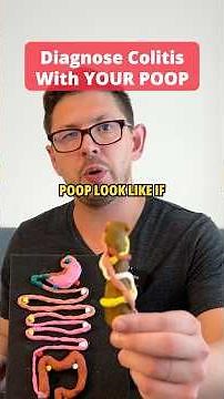 How To Diagnose Colitis With Your Poop!