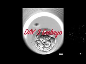 IVF Explained: A Step-by-Step Guide to In Vitro Fertilisation