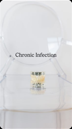 Hygiene Edge on Instagram: "A look at chronic infection in a periodontally involved patient."