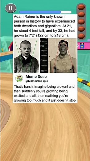 Dwarfism + gigantism #memes #foryou