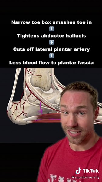 Understanding Plantar Fasciitis and Its Connection to Narrow Shoes
