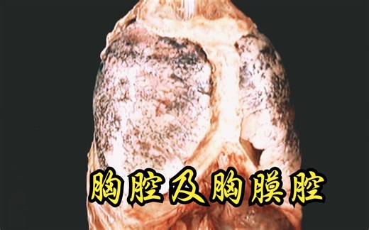 胸腔及胸膜腔（纵膈、胸膜）