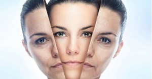 Cirurgião Plástico explica como eliminar o bigode chinês em cada faixa etária