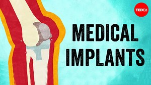 1M views · 3.5K reactions | Why do medical implants like insulin pumps and prosthetic knees need replacement? Take a look at how your body fights implants and how new devices are trying to help: | TED-Ed | Facebook
