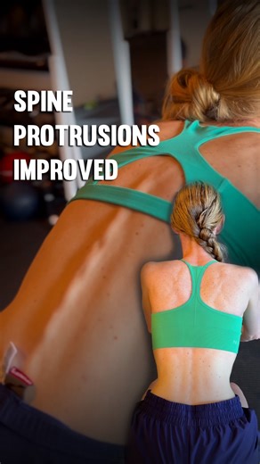 Functional Patterns on Instagram: "Prior to starting FP, LeAnn had already tried just about everything people are usually told to try: stretching, chiropractic, acupuncture, HIIT training, supplements, biking, and running. Three years before FP, she had a major health event after getting COVID. Her systems essentially crashed. Her body locked itself into a long-term protective state and never fully came out of it. She dealt with neurological symptoms, POTS, poor sleep, nervous system dysregulati