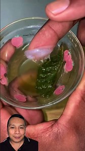 Remedio para eliminar dolor de odio, hongos, tos y resfriado #receta #tips #remedio