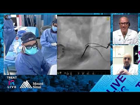 Transjugular Intrahepatic Portosystemic Shunt (TIPS) for Portomesenteric Thrombosis and Varices