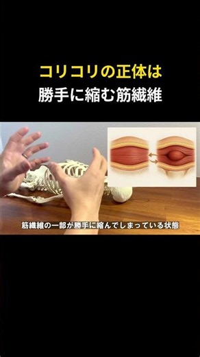 What Exactly Is That Muscle Knot?