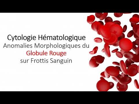 CYTOLOGIE HEMATOLOGIQUE : Part 1 Anomalies du Globule Rouge (Hematology)