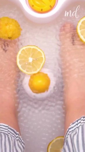 Combine Aspirin with Lemon to remove hard foot skin, corns & calluses 🍋 #nails #summer #aspirin