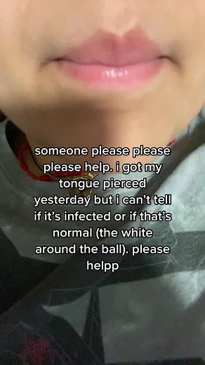 Snake Eyes Tongue Piercing: White Bump - Infection or Normal?