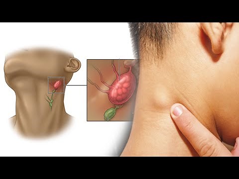7 Easy Ways To Quickly Unclog Your Lymph Nodes To Reduce Swelling And Flush Out Toxins ⚫healthcare☑️