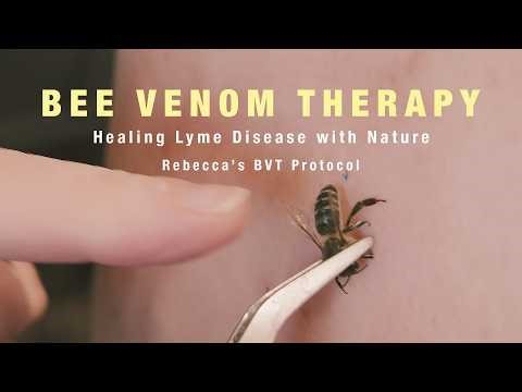 Bee Venom Therapy - Healing Lyme Disease with Nature - How we sting