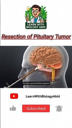 Resection of Pituitary Tumor | Transsphenoidal Surgery Explained #Neurosurgery #medicalshorts