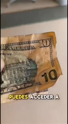 22K views · 160 reactions | A Victoria Figueroa le salió un absceso a...