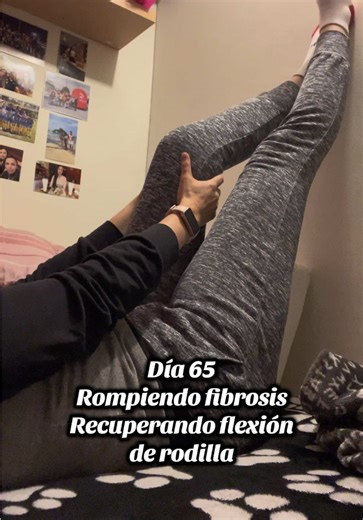Día 65: Rompiendo Fibrosis y Recuperando Flexión