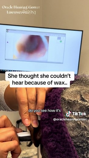 Understanding Fluid Behind the Eardrum: Causes and Symptoms