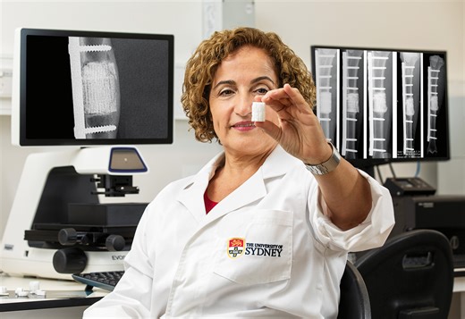 Meet the engineer 3D printing human bones