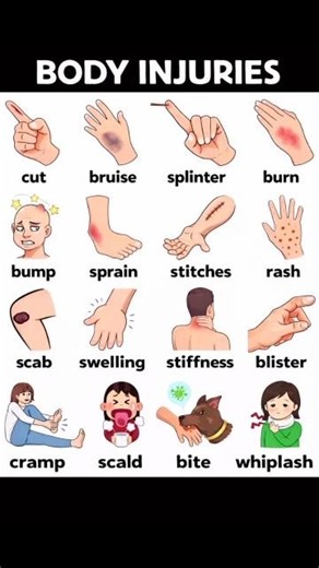 Common Body Injuries Everyone Should Know 😳