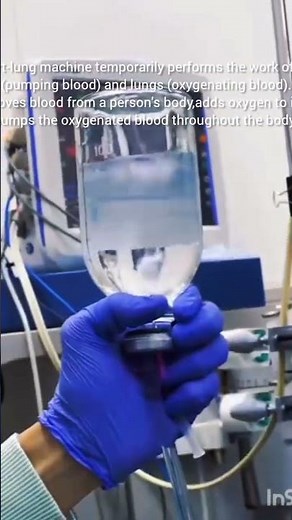 What is Heart Lung Machine #perfusion #cardiacperfusion