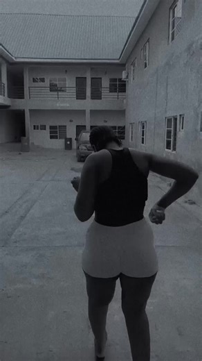 Understanding Bow Legs and Their Impact