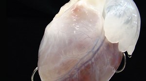 Replacing Body Parts — NOVA | PBS