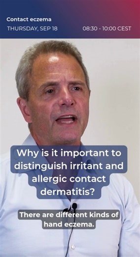 Distinguishing between irritant and allergic contact dermatitis, as well as subtypes of hand eczema like hyperkeratotic HE, dyshidrotic HE, and protein contact dermatitis, is essential for guiding accurate diagnosis, testing, and treatment strategies. To discover more on common and emerging allergens, eczema prevention and management, and the latest treatment options for contact eczema, join us at the #EADVCongress in Paris and attend the session “Contact Eczema” by Claus Zachariae. 🗓 When? Thu