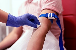 Thyroïde : à quoi correspond le dosage de la TSH ?