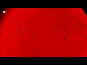 Everything you need to know about urogenital trichomonas under a microscope #new #foryou