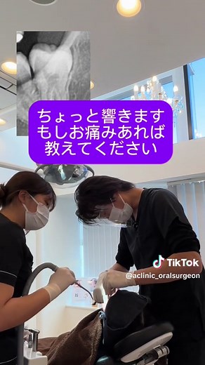 痛くない親知らず抜歯の実例